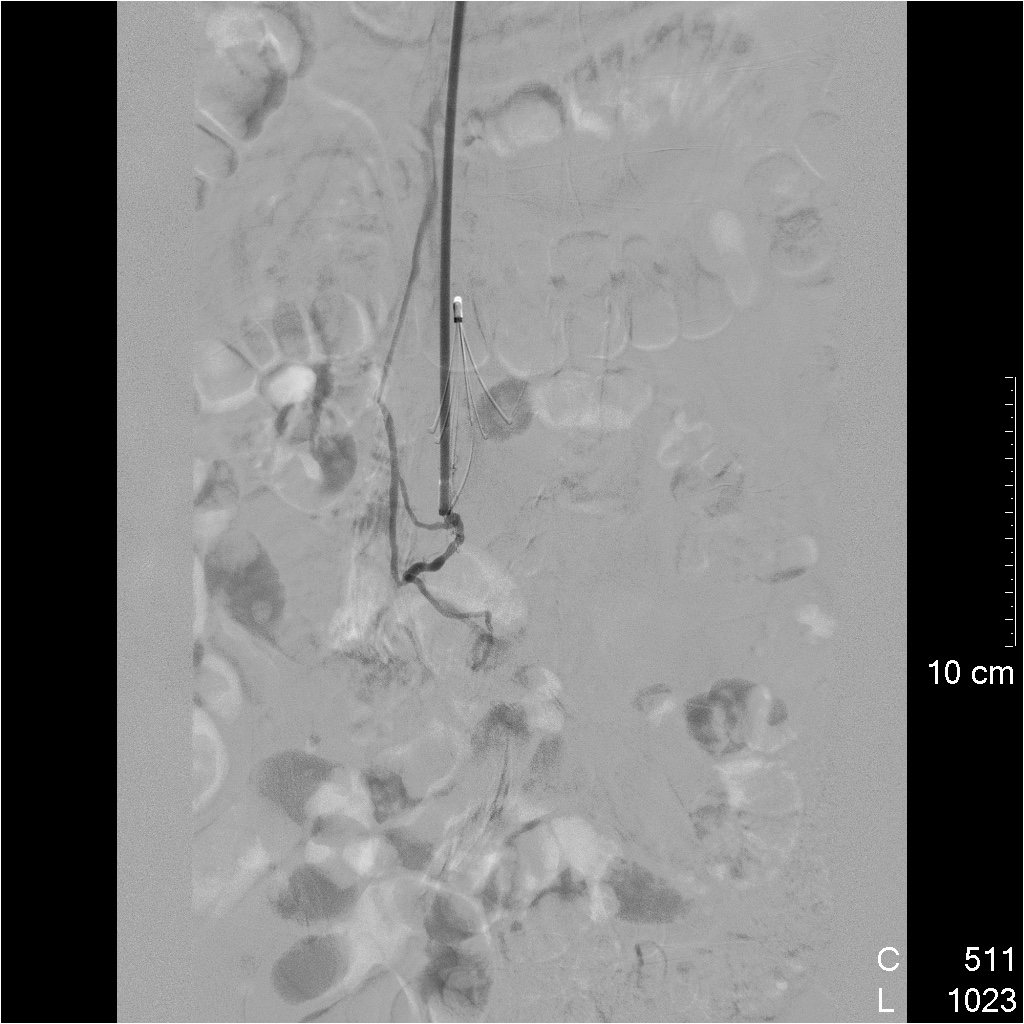 RACHIS%20DORSO%20LOMB%20SAG%204MM